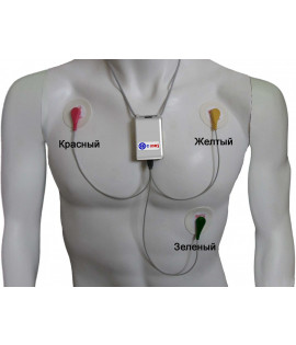 SDM3 (Холтер ЕКГ)