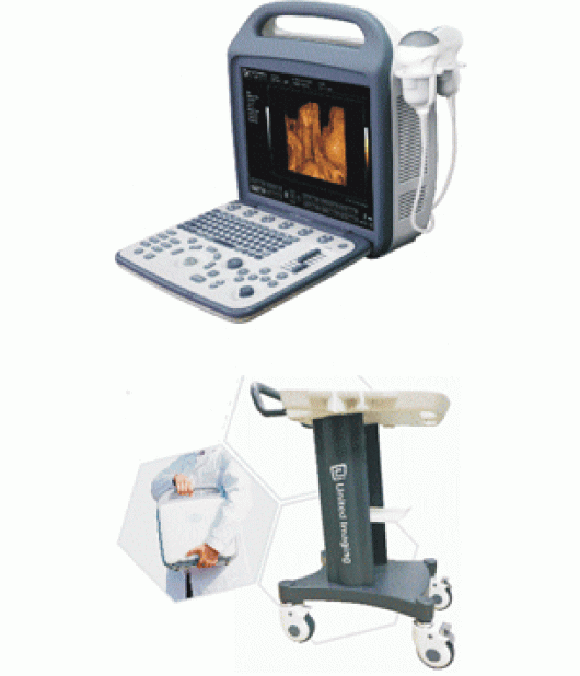 iuStar 160
