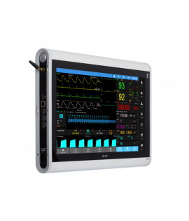 Монітор пацієнта ЮМ 300-20