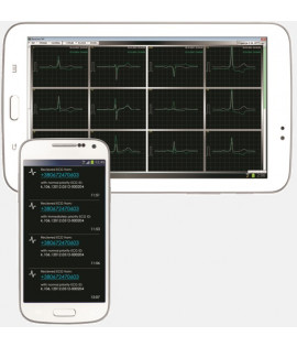 Телеметричний кардіологічний комплекс UNET